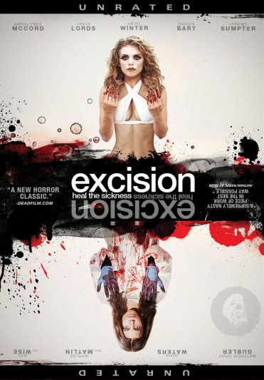 Excision